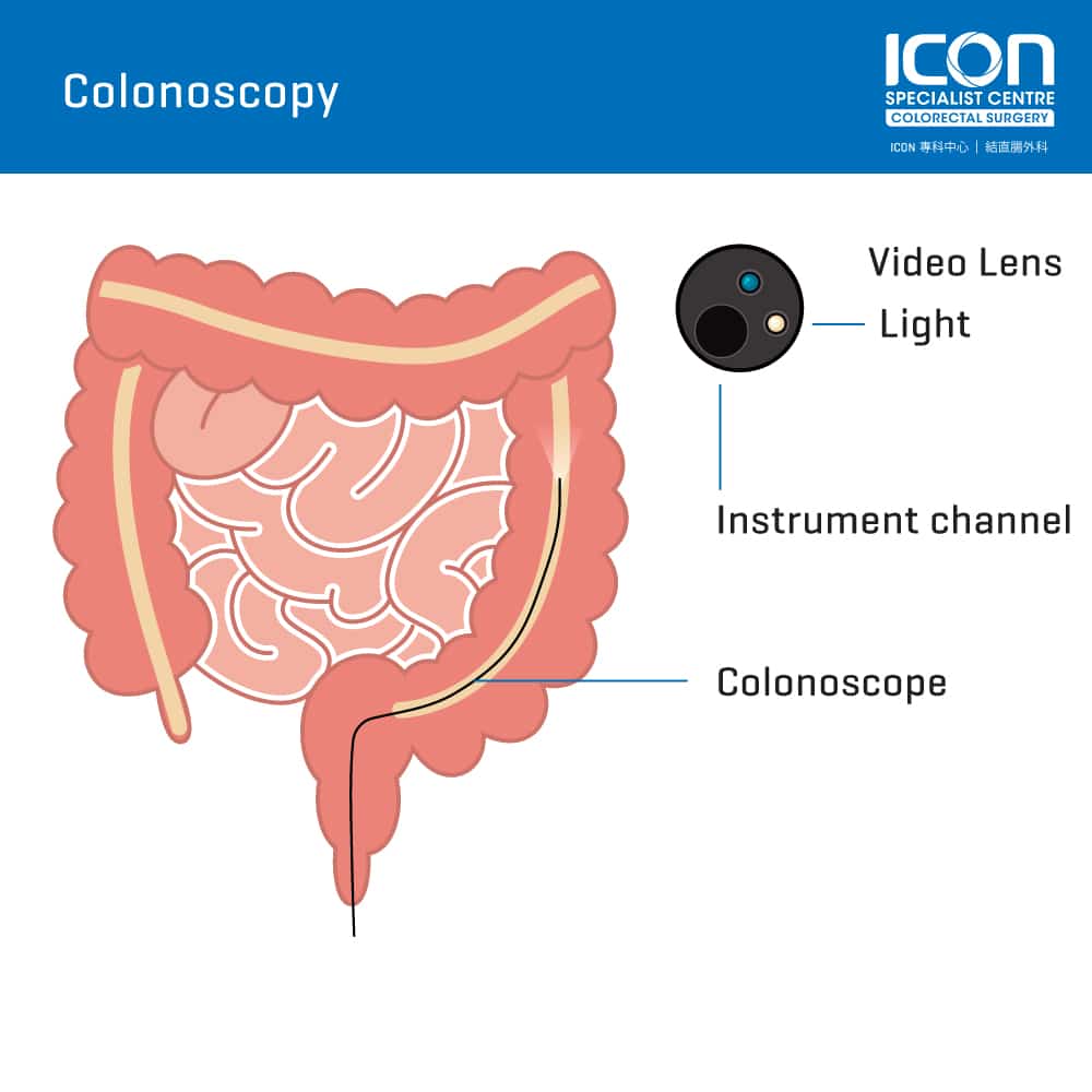 Colonoscopy Anatomy 